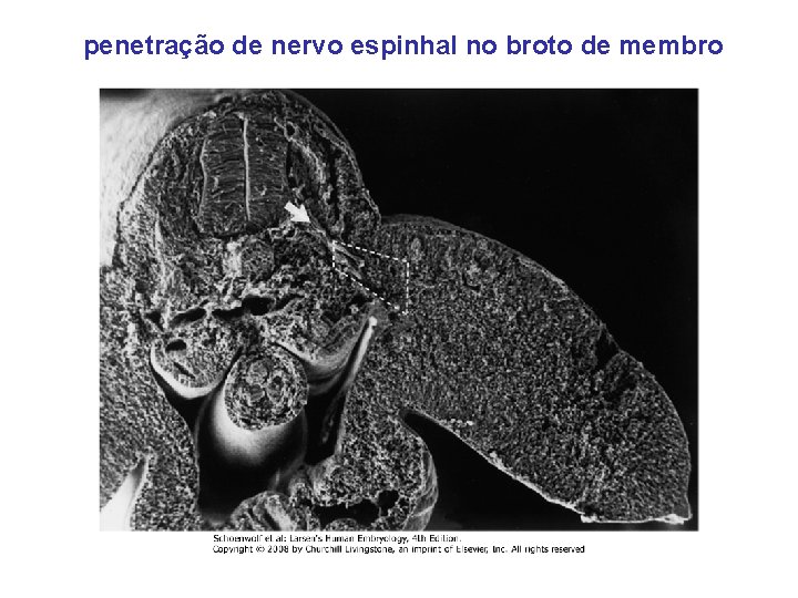 penetração de nervo espinhal no broto de membro 