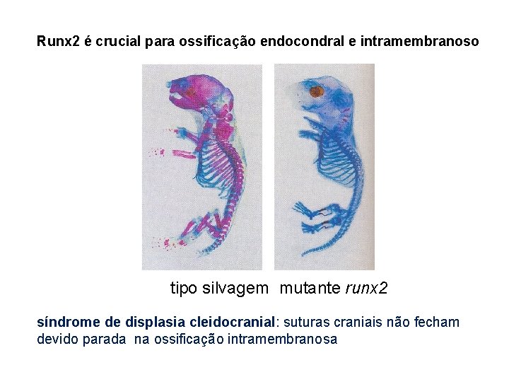 Runx 2 é crucial para ossificação endocondral e intramembranoso tipo silvagem mutante runx 2