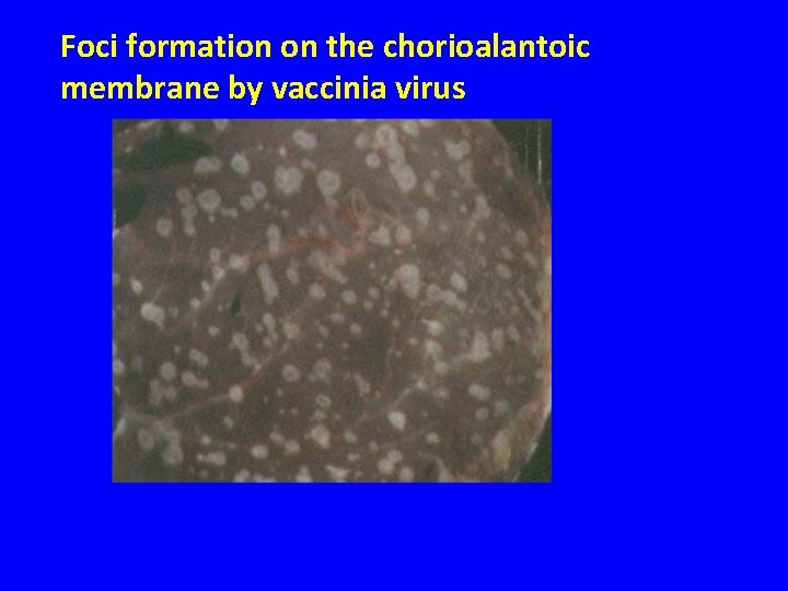 Foci formation on the chorioalantoic membrane by vaccinia virus 