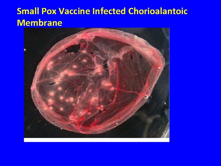 Small Pox Vaccine Infected Chorioalantoic Membrane 