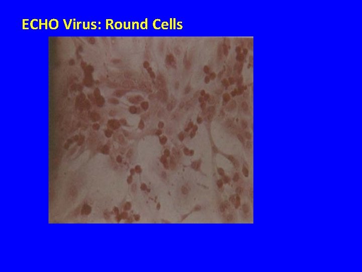 ECHO Virus: Round Cells 