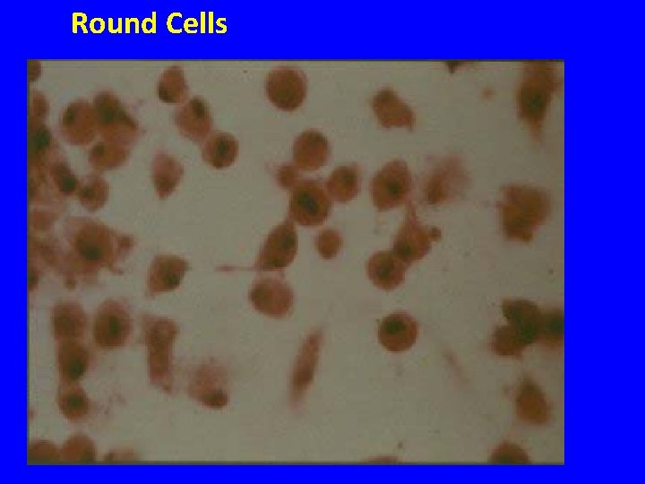 Round Cells 