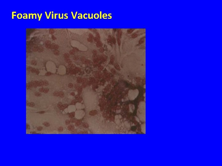 Foamy Virus Vacuoles 