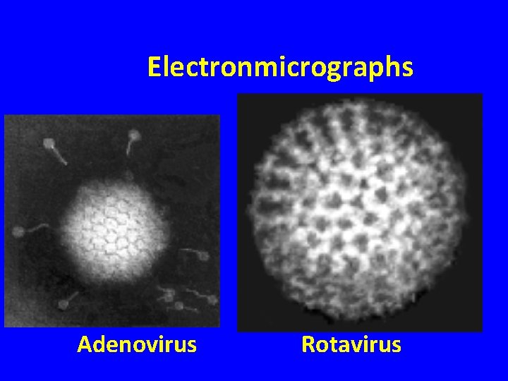 Electronmicrographs Adenovirus Rotavirus 