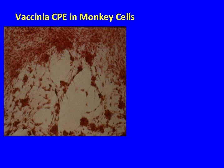 Vaccinia CPE in Monkey Cells 