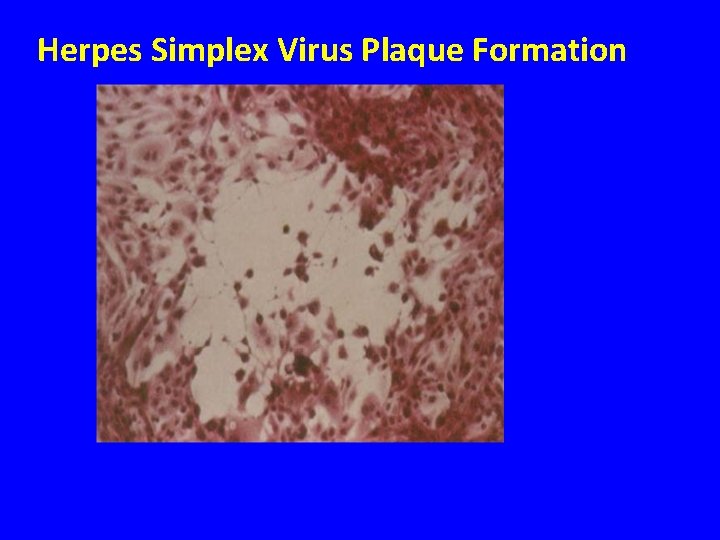 Herpes Simplex Virus Plaque Formation 