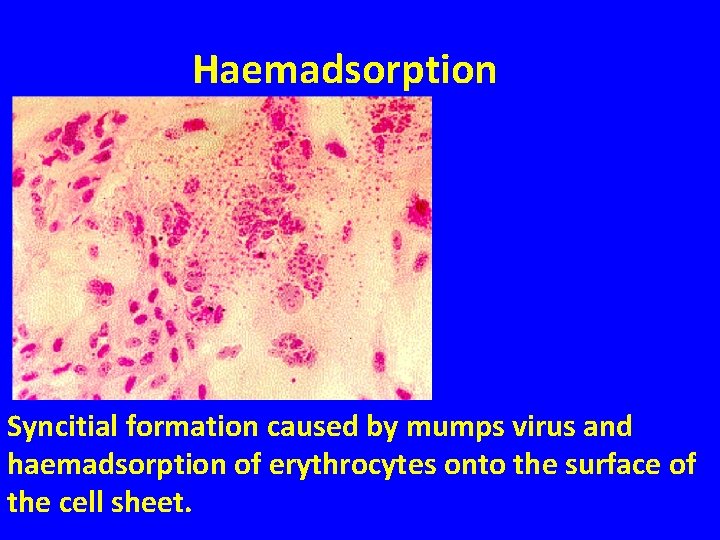 Haemadsorption Syncitial formation caused by mumps virus and haemadsorption of erythrocytes onto the surface