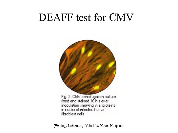 DEAFF test for CMV (Virology Laboratory, Yale-New Haven Hospital) 