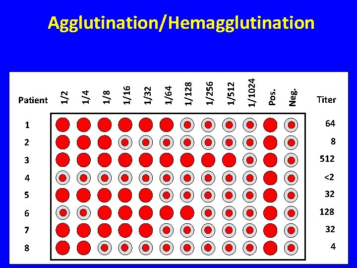 Neg. Pos. 1/1024 1/512 1/256 1/128 1/64 1/32 1/16 1/8 1/4 Patient 1/2 Agglutination/Hemagglutination