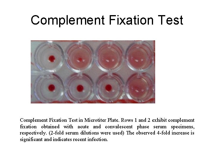 Complement Fixation Test in Microtiter Plate. Rows 1 and 2 exhibit complement fixation obtained