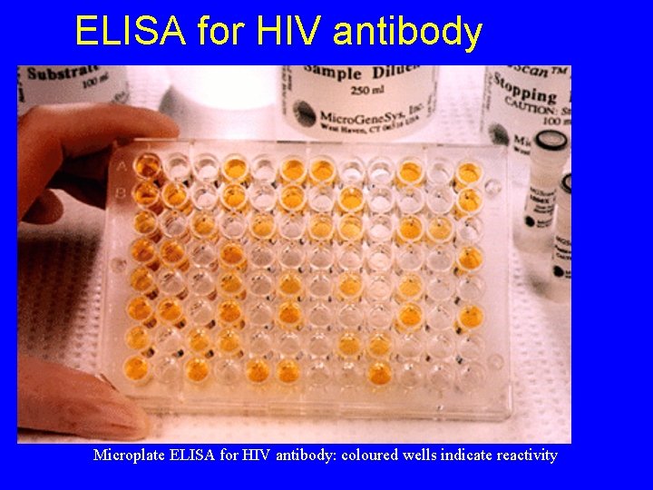 ELISA for HIV antibody Microplate ELISA for HIV antibody: coloured wells indicate reactivity 