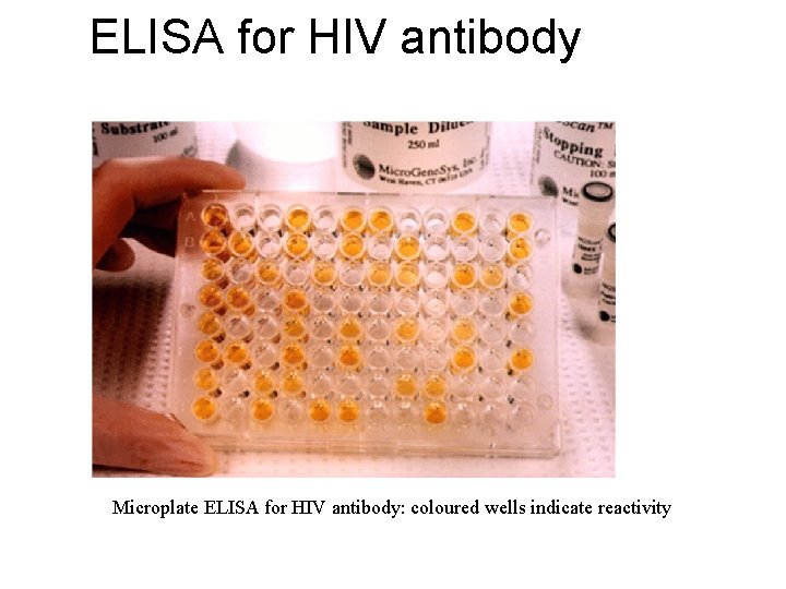 ELISA for HIV antibody Microplate ELISA for HIV antibody: coloured wells indicate reactivity 