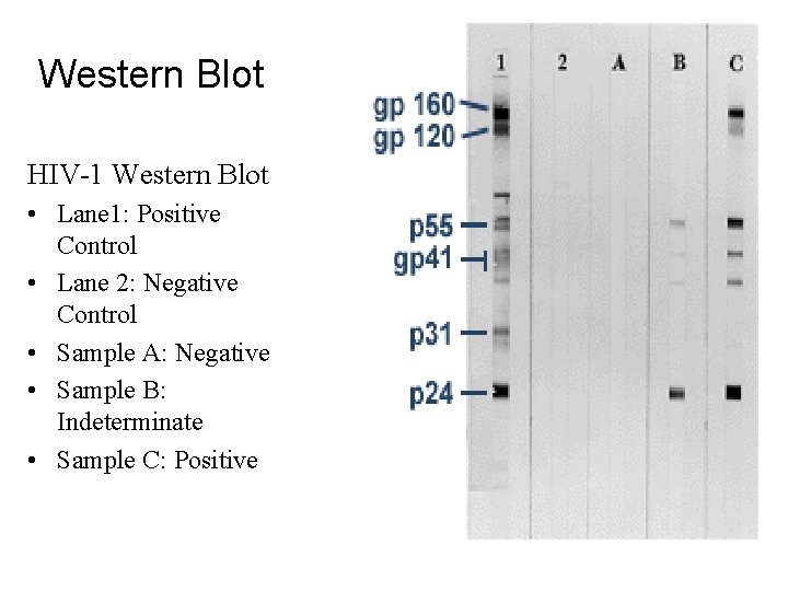 Western Blot HIV-1 Western Blot • Lane 1: Positive Control • Lane 2: Negative