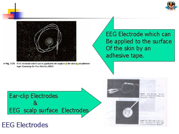 EEG Electrode which can Be applied to the surface Of the skin by an