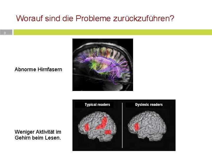 Worauf sind die Probleme zurückzuführen? 8 http: //www. spektrum. de/alias/hirnforschung /pfadfinder-durch-die-weissesubstanz/1071715 Abnorme Hirnfasern Weniger