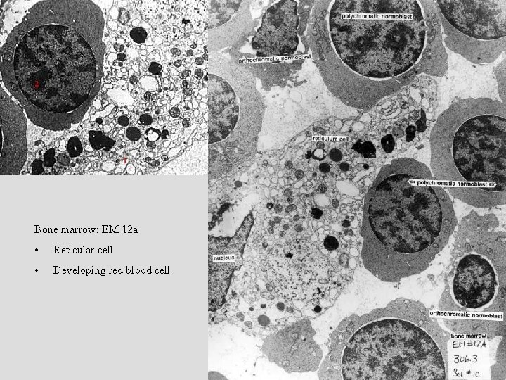 Bone marrow: EM 12 a • Reticular cell • Developing red blood cell Bone marrow: EM 12 a • Reticular cell • Developing red blood cell