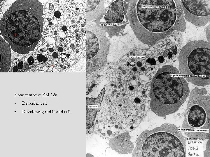 Bone marrow: EM 12 a • Reticular cell • Developing red blood cell 