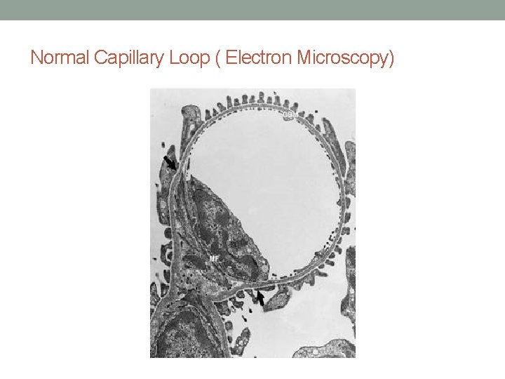 Normal Capillary Loop ( Electron Microscopy) 