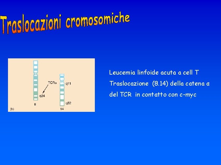 Leucemia linfoide acuta a cell T Traslocazione (8. 14) della catena α del TCR