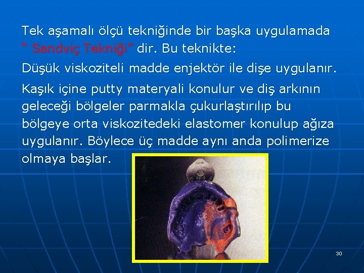 Tek aşamalı ölçü tekniğinde bir başka uygulamada “ Sandviç Tekniği” dir. Bu teknikte: Düşük