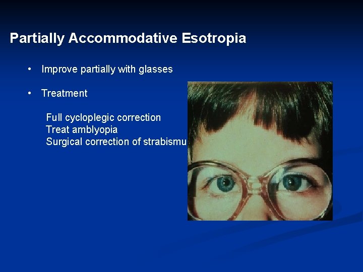 Partially Accommodative Esotropia • Improve partially with glasses • Treatment Full cycloplegic correction Treat