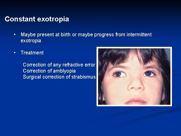 Constant exotropia • Maybe present at birth or maybe progress from intermittent exotropia •