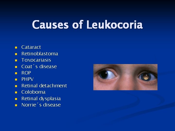 Causes of Leukocoria n n n n n Cataract Retinoblastoma Toxocariasis Coat´s disease ROP