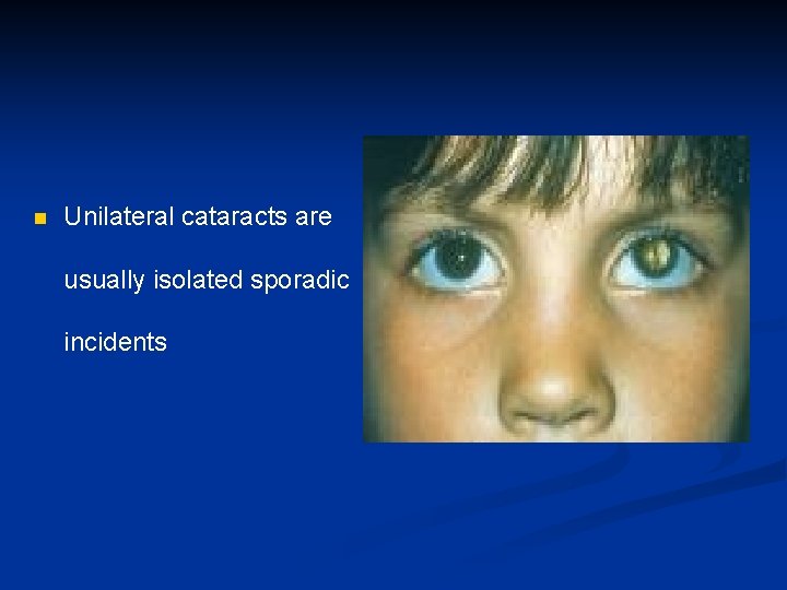 n Unilateral cataracts are usually isolated sporadic incidents 