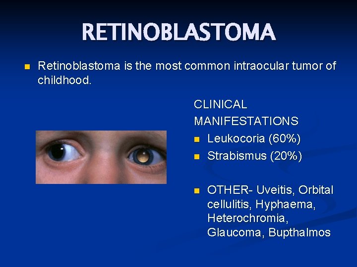 RETINOBLASTOMA n Retinoblastoma is the most common intraocular tumor of childhood. CLINICAL MANIFESTATIONS n