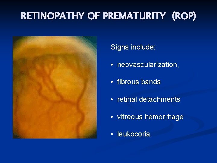 RETINOPATHY OF PREMATURITY (ROP) Signs include: • neovascularization, • fibrous bands • retinal detachments