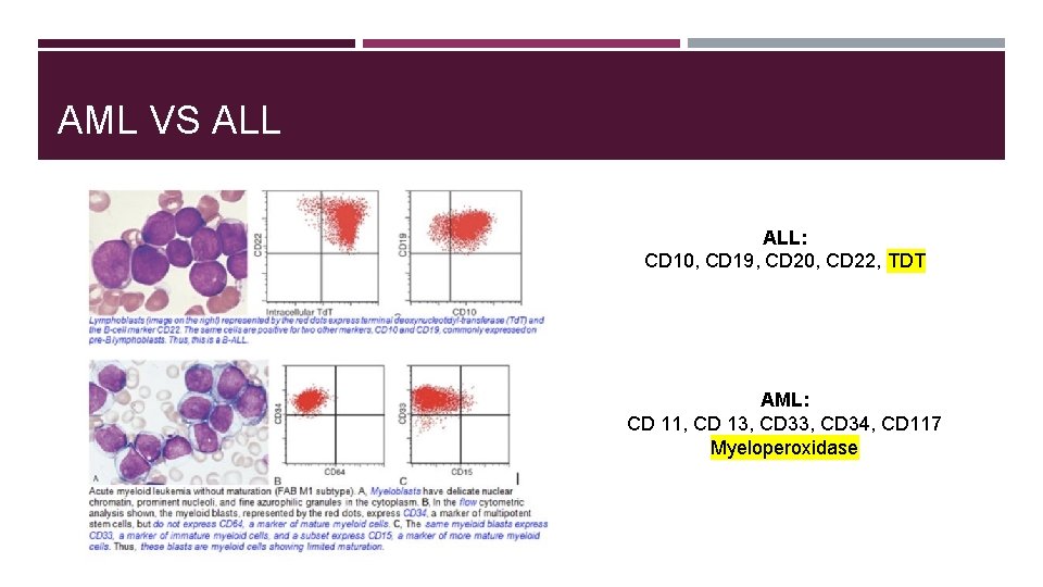 AML VS ALL: CD 10, CD 19, CD 20, CD 22, TDT AML: CD