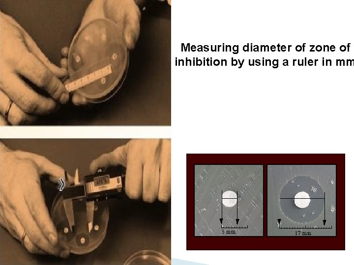 Measuring diameter of zone of inhibition by using a ruler in mm 