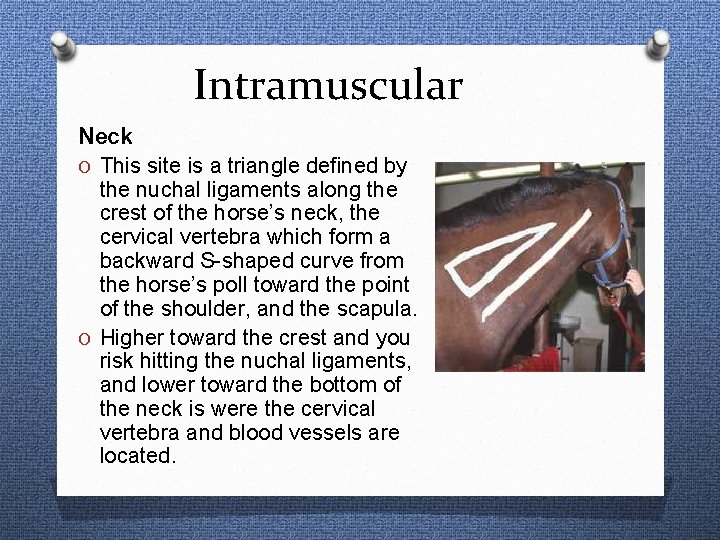 Intramuscular Neck O This site is a triangle defined by the nuchal ligaments along