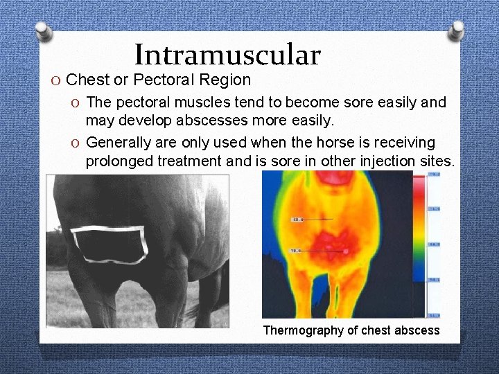 Intramuscular O Chest or Pectoral Region O The pectoral muscles tend to become sore