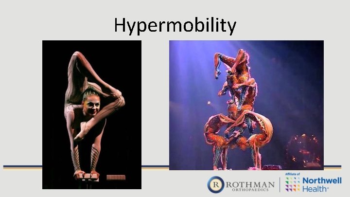 Hypermobility 