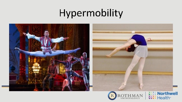 Hypermobility 