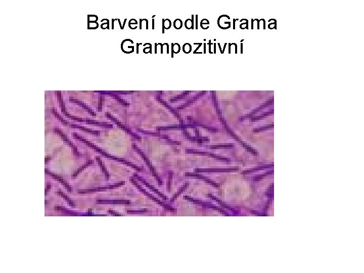 Barvení podle Grama Grampozitivní 