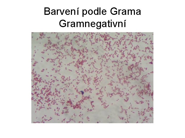 Barvení podle Grama Gramnegativní 