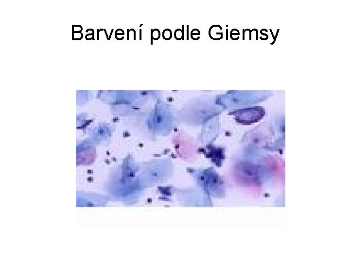 Barvení podle Giemsy 