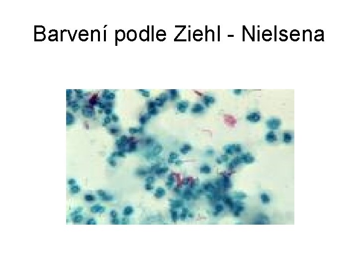 Barvení podle Ziehl - Nielsena 