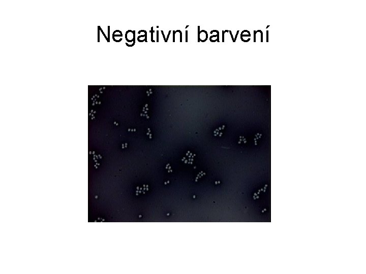 Negativní barvení 