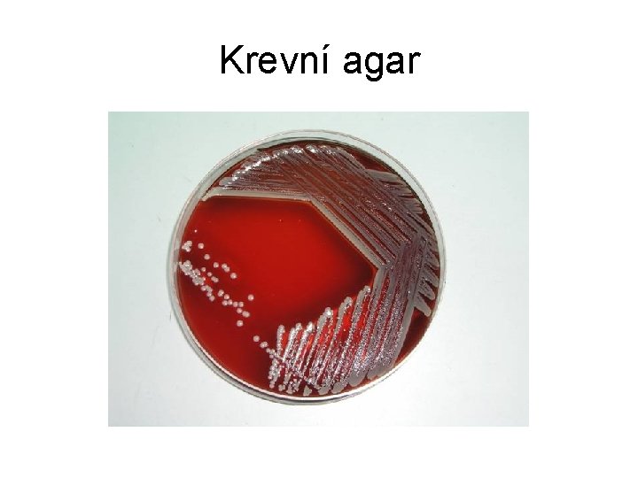 Krevní agar 