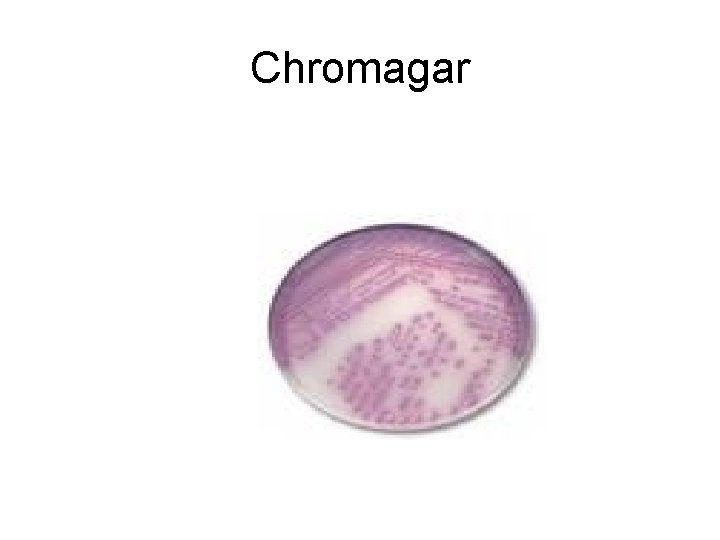 Chromagar 