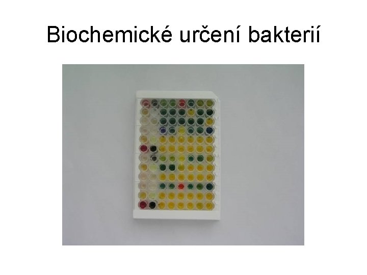Biochemické určení bakterií 
