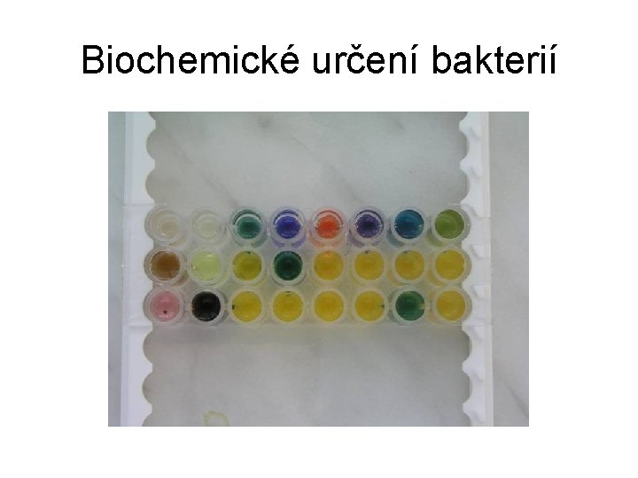 Biochemické určení bakterií 