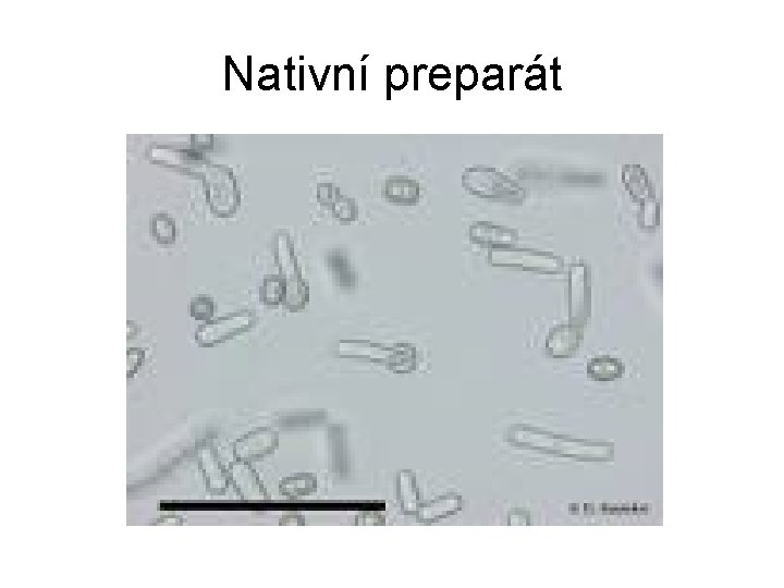 Nativní preparát 