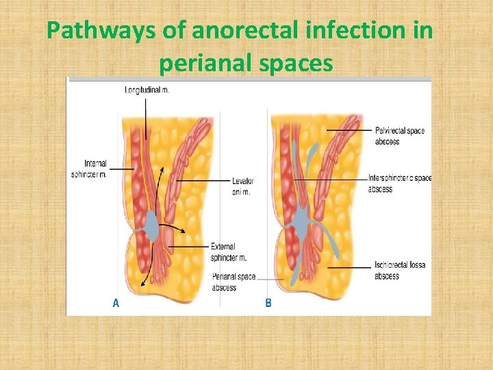 Pathways of anorectal infection in perianal spaces 