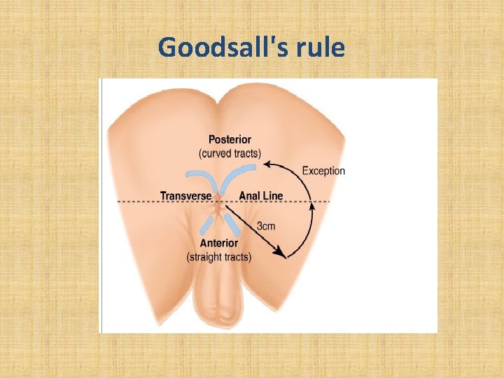 Goodsall's rule 