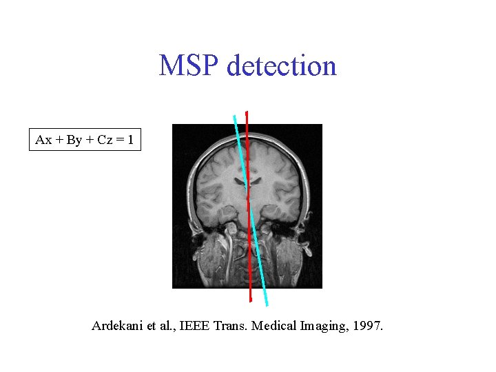 MSP detection Ax + By + Cz = 1 Ardekani et al. , IEEE