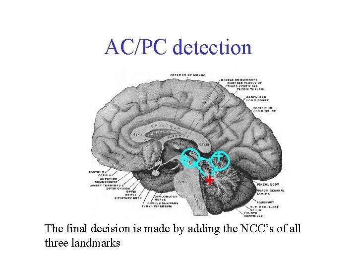 AC/PC detection The final decision is made by adding the NCC’s of all three